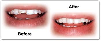 Andover dentists | Dr. Wojtkun | Dr Sendek